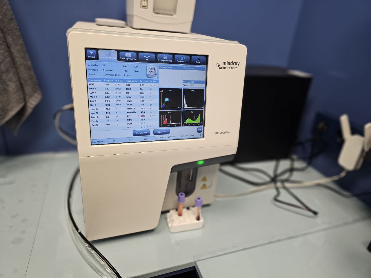 Снятие зубного камня